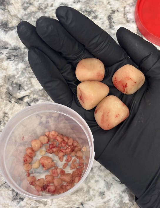 cat or dog peeing more than usual, Bladder stones removed